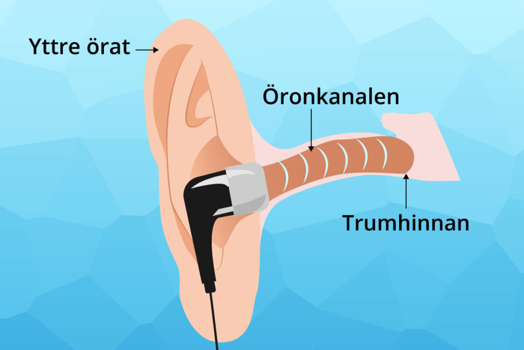 placement_diagram